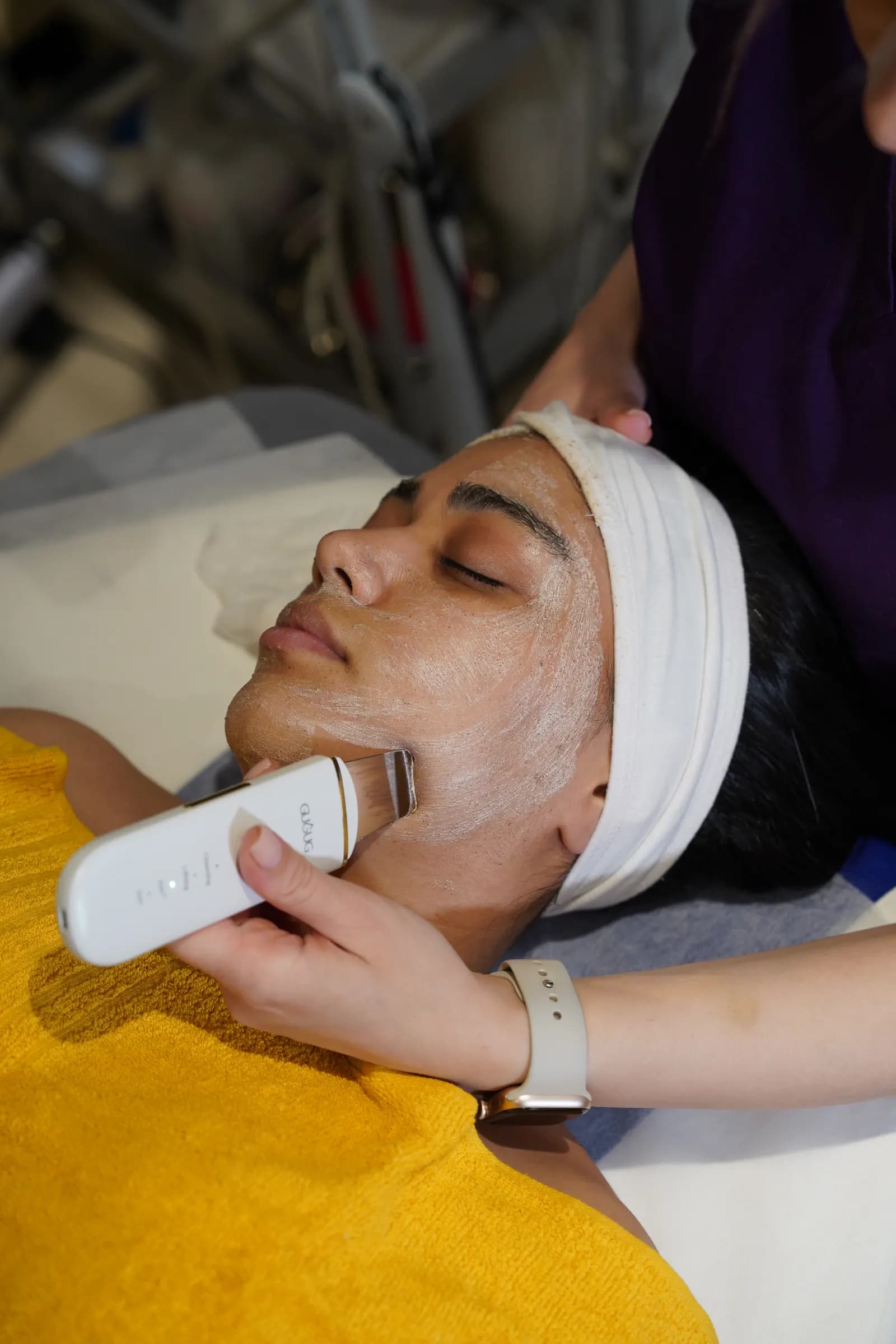 Microdermabrasion exfoliation treatment on the client's face